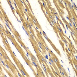 Superoxide Dismutase 2 (SOD2) Antibody