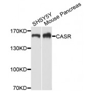 Western blot analysis of extracts of various cell lines, using CASR antibody (abx001232) at 1/1000 dilution.