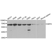 Western blot analysis of extracts of various cell lines, using G6PD antibody (abx001294) at 1/1000 dilution.