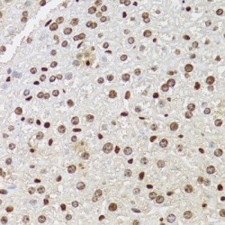 Homeobox Protein CDX-2 (CDX2) Antibody