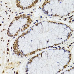 Homeobox Protein CDX-2 (CDX2) Antibody