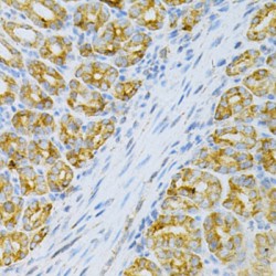 Oxidized Low Density Lipoprotein Receptor 1 (OLR1) Antibody