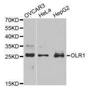 Western blot analysis of extracts of various cell lines, using OLR1 antibody (abx001381) at 1/1000 dilution.