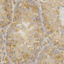 Oxidized Low Density Lipoprotein Receptor 1 (OLR1) Antibody