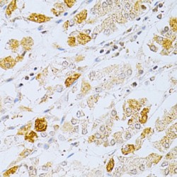 Oxidized Low Density Lipoprotein Receptor 1 (OLR1) Antibody