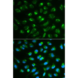 Interleukin 7 (IL7) Antibody