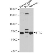 Western blot analysis of extracts of various cell lines, using BTRC antibody (abx001393) at 1/1000 dilution.