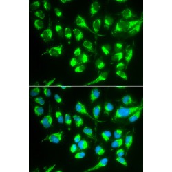 Solute Carrier Family 22 Member 5 (SLC22A5) Antibody