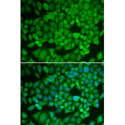 Nuclear Receptor Subfamily 0, Group B, Member 1 (NR0B1) Antibody