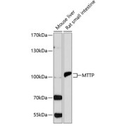 Western blot analysis of extracts of various cell lines, using MTTP antibody (1/1000 dilution).