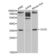 Western blot analysis of extracts of various cell lines, using CD1D antibody (abx001460) at 1/1000 dilution.