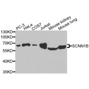 Western blot analysis of extracts of various cell lines, using SCNN1B antibody (abx001464) at 1/1000 dilution.