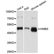 Western blot analysis of extracts of various cell lines, using HMBS antibody (abx001474) at 1/1000 dilution.