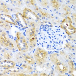 MAPK/MAK/MRK Overlapping Kinase (MOK) Antibody