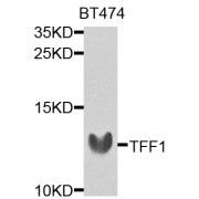 Western blot analysis of extracts of BT-474 cells, using TFF1 antibody (abx001483) at 1/1000 dilution.