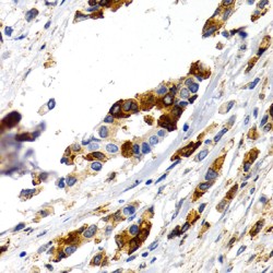 Trefoil Factor 1 (TFF1) Antibody