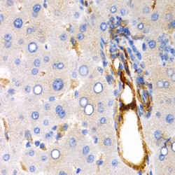 Trefoil Factor 1 (TFF1) Antibody