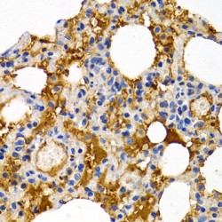 Trefoil Factor 1 (TFF1) Antibody