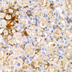 Trefoil Factor 1 (TFF1) Antibody