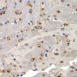 Trefoil Factor 1 (TFF1) Antibody