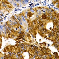 Trefoil Factor 1 (TFF1) Antibody