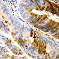 Trefoil Factor 1 (TFF1) Antibody