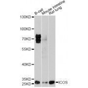 Western blot analysis of extracts of various cell lines, using ICOS antibody (abx001498) at 1/1000 dilution.