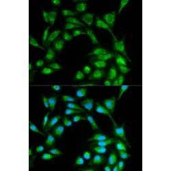 Inducible T-Cell Costimulator (ICOS) Antibody