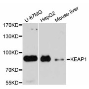 Western blot analysis of extracts of various cell lines, using KEAP1 antibody (abx001504) at 1/1000 dilution.