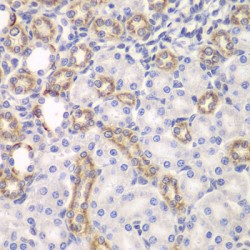 Kelch Like ECH Associated Protein 1 (KEAP1) Antibody