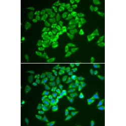 Kelch Like ECH Associated Protein 1 (KEAP1) Antibody