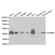 Western blot analysis of extracts of various cell lines, using CXADR antibody (abx001505) at 1/1000 dilution.