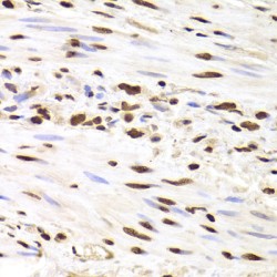 Heterogeneous Nuclear Ribonucleoprotein D (HNRNPD) Antibody