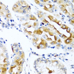 C-C Motif Chemokine 21 (CCL21) Antibody