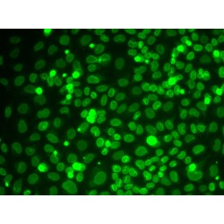 Lamin B1 (LMNB1) Antibody