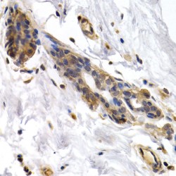 Pyruvate Kinase, Liver And RBC (PKLR) Antibody