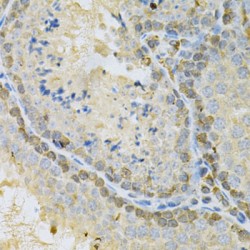 Mitotic Checkpoint Serine/threonine-Protein Kinase BUB1 (BUB1) Antibody