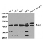 Western blot analysis of extracts of various cell lines, using PGK1 antibody (abx001601) at 1/1000 dilution.