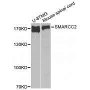 Western blot analysis of extracts of various cell lines, using SMARCC2 antibody (abx001602) at 1/1000 dilution.