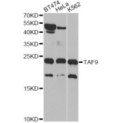 Western blot analysis of extracts of various cell lines, using TAF9 antibody (abx001640) at 1/1000 dilution.