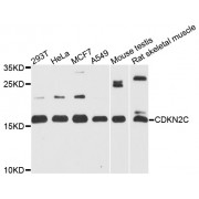 Western blot analysis of extracts of various cell lines, using CDKN2C antibody (abx001659) at 1/1000 dilution.