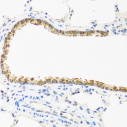 Cyclin Dependent Kinase 4 Inhibitor C (CDKN2C) Antibody