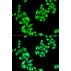 Inhibitor of Nuclear Factor Kappa-B Kinase Subunit Beta / IKKB (IKBKB) Antibody