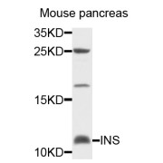 Western blot analysis of extracts of mouse pancreas, using INS antibody (abx001702) at 1/1000 dilution.