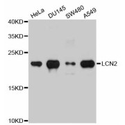 Western blot analysis of extracts of various cell lines, using LCN2 antibody (abx001704) at 1/1000 dilution.