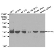 Western blot analysis of extracts of various cell lines, using PPP4C antibody (abx001721) at 1/1000 dilution.