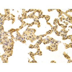 Protein Phosphatase 4 Catalytic Subunit (PPP4C) Antibody