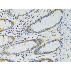 Protein Phosphatase 4 Catalytic Subunit (PPP4C) Antibody