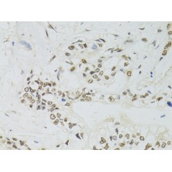 Protein Phosphatase 4 Catalytic Subunit (PPP4C) Antibody