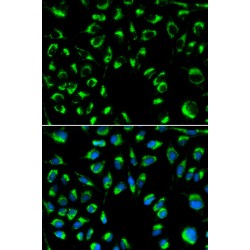 Protein Phosphatase 4 Catalytic Subunit (PPP4C) Antibody